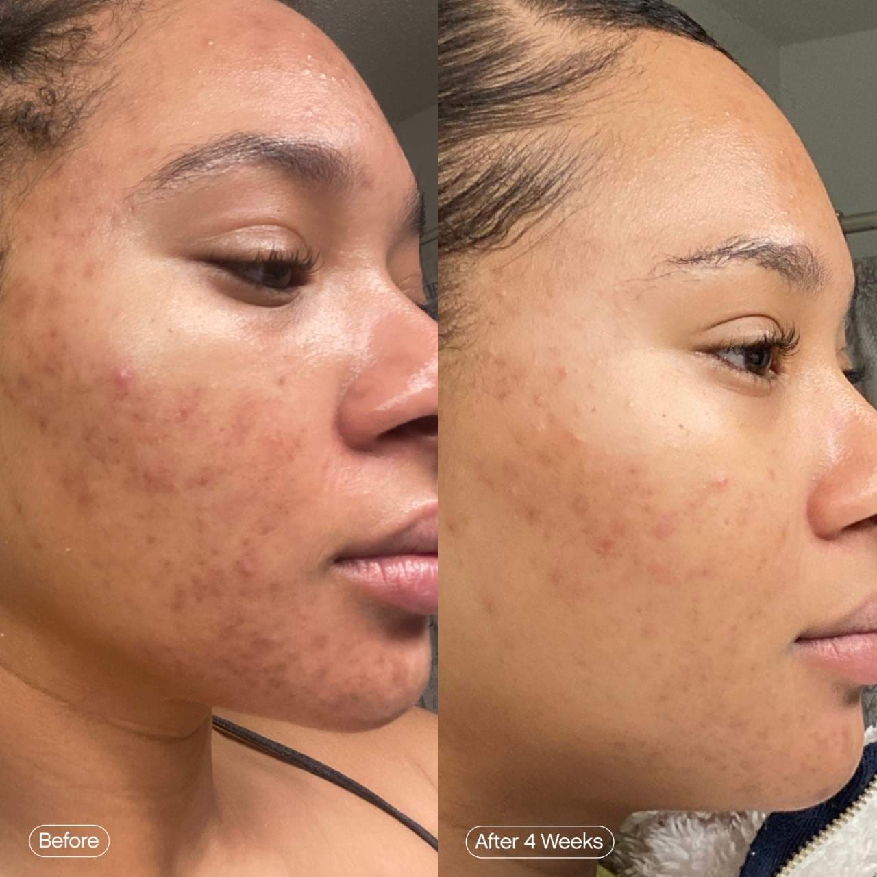 Topicals - Faded Serum for Dark Spots & Discoloration | 50 mL