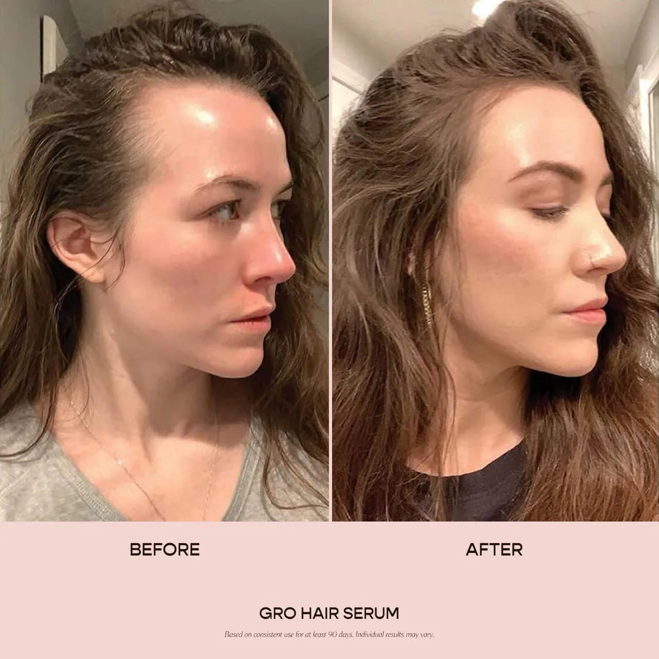 VEGAMOUR - GRO Hair Serum | 30 ML