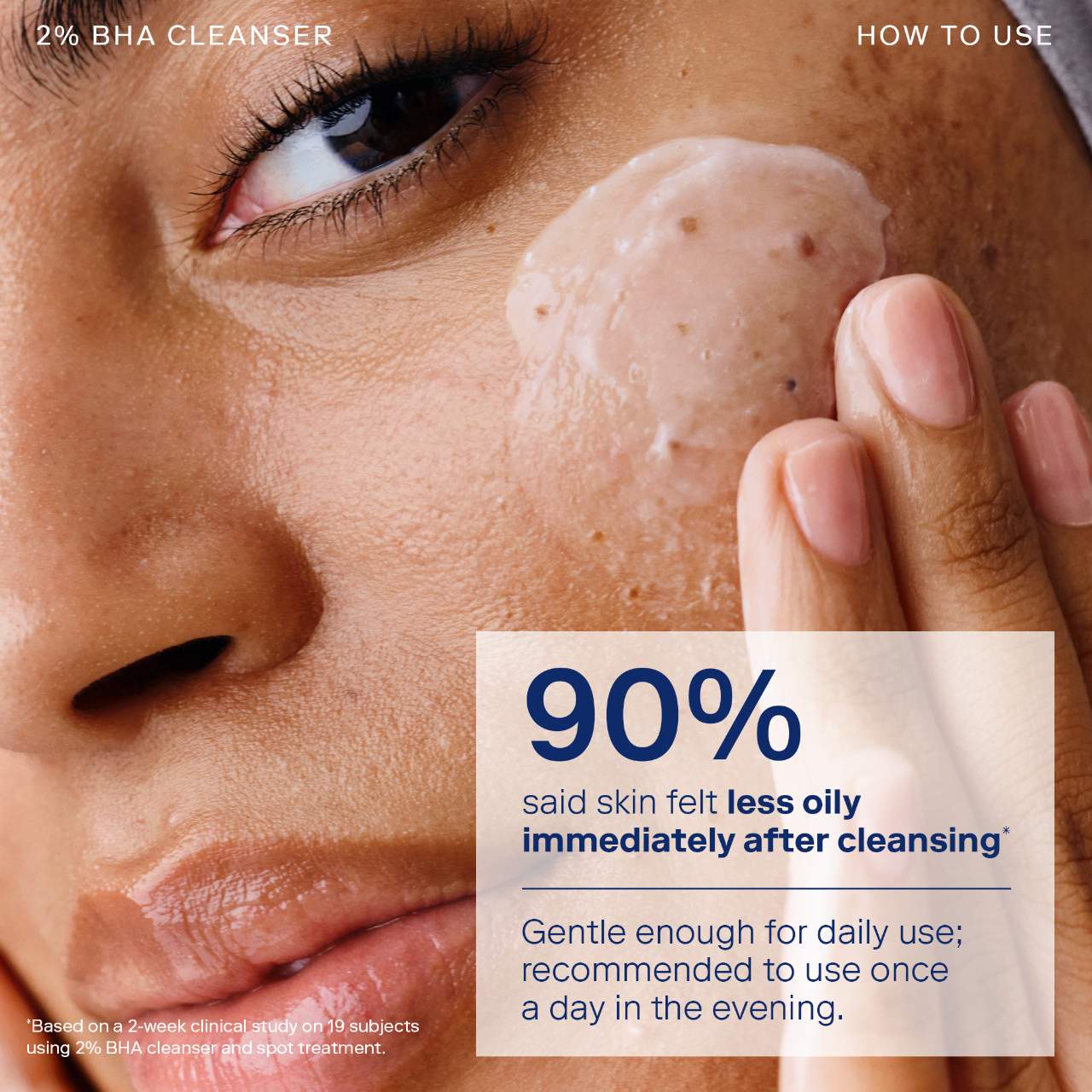 Skinfix - Acne+ 2% BHA + Azelaic Acid + Niacinamide + AHA Cleanser | 148 mL