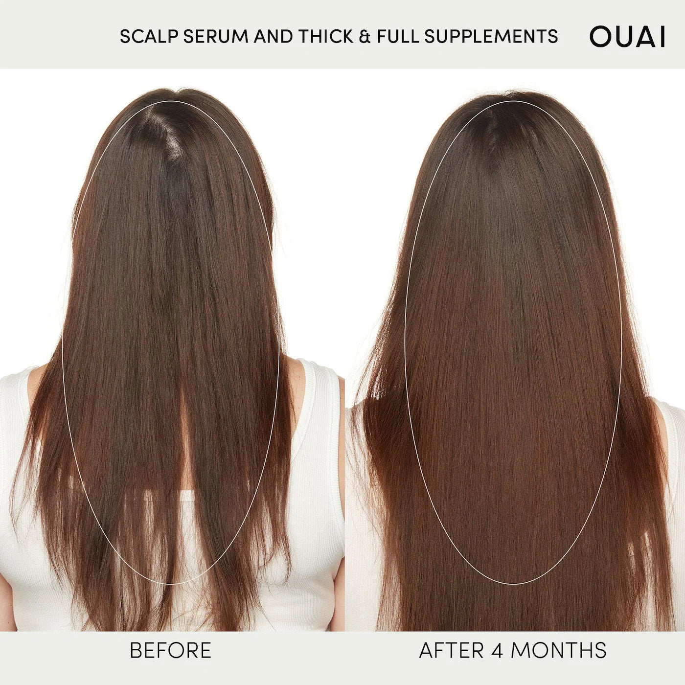 OUAI - Hydrating Scalp Serum for Healthy, Fuller Looking Hair | 60 mL