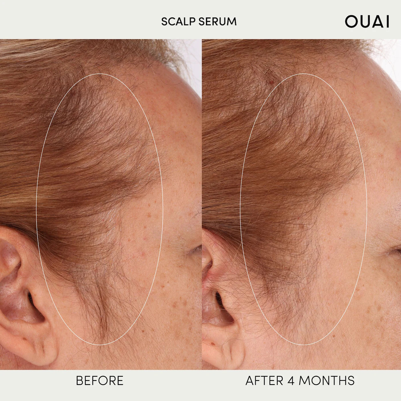 OUAI - Hydrating Scalp Serum for Healthy, Fuller Looking Hair | 60 mL