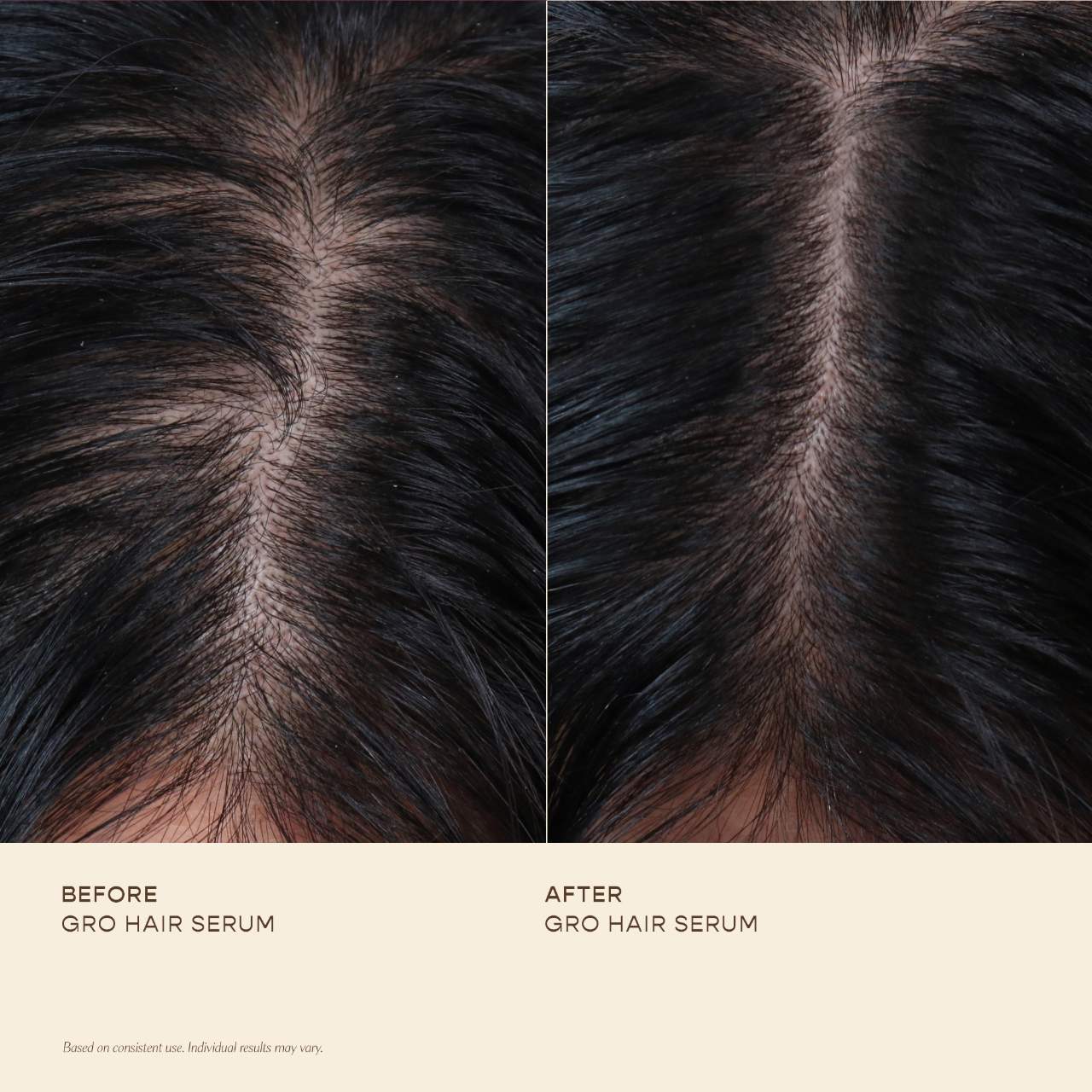 Vegamour - GRO Hair Serum Trio Set for Thinning Hair
