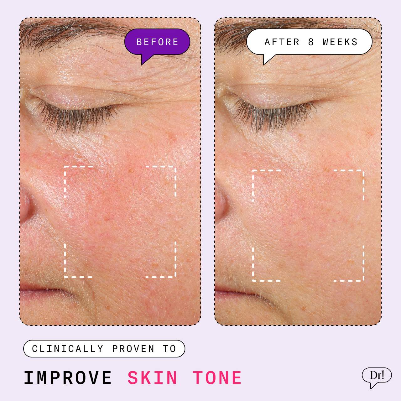 Dr. Idriss  - Major Fade Hyper Serum Dark Spot Treatment