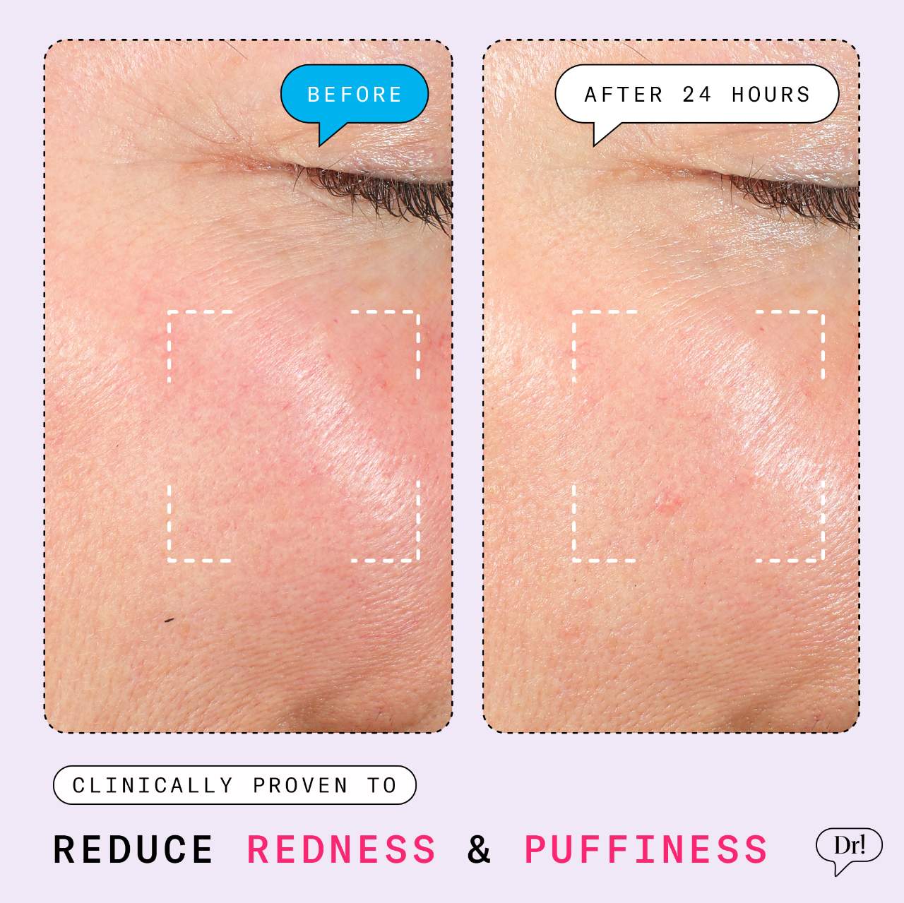Dr. Idriss  - THE DEPUFFER REDNESS REDUCING +MDEPUFFING ROLL-ON SERUM