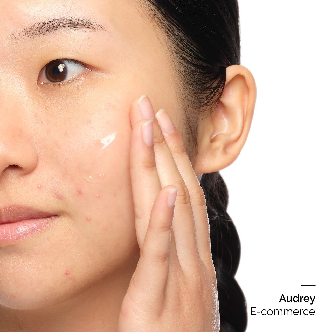 The Ordinary - Aloe 2% + NAG 2% Solution | 30 mL
