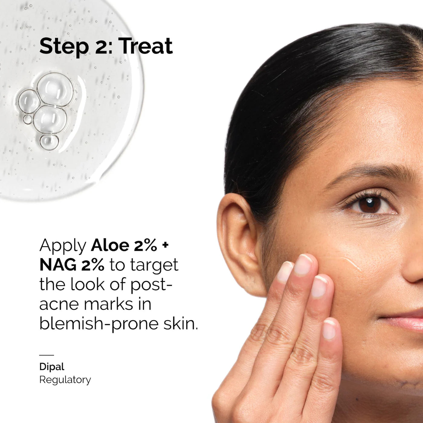 The Ordinary - Aloe 2% + NAG 2% Solution | 30 mL