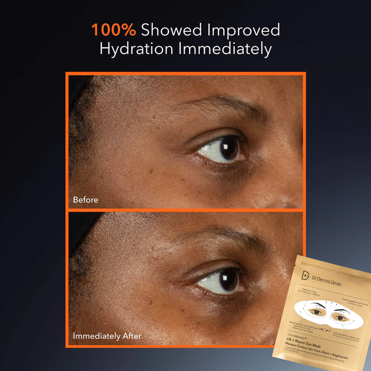 Dr. Dennis Gross Skincare - DermInfusions™ Lift + Repair Eye Mask