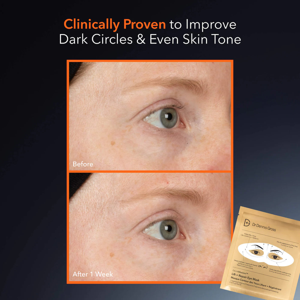 Dr. Dennis Gross Skincare - DermInfusions™ Lift + Repair Eye Mask