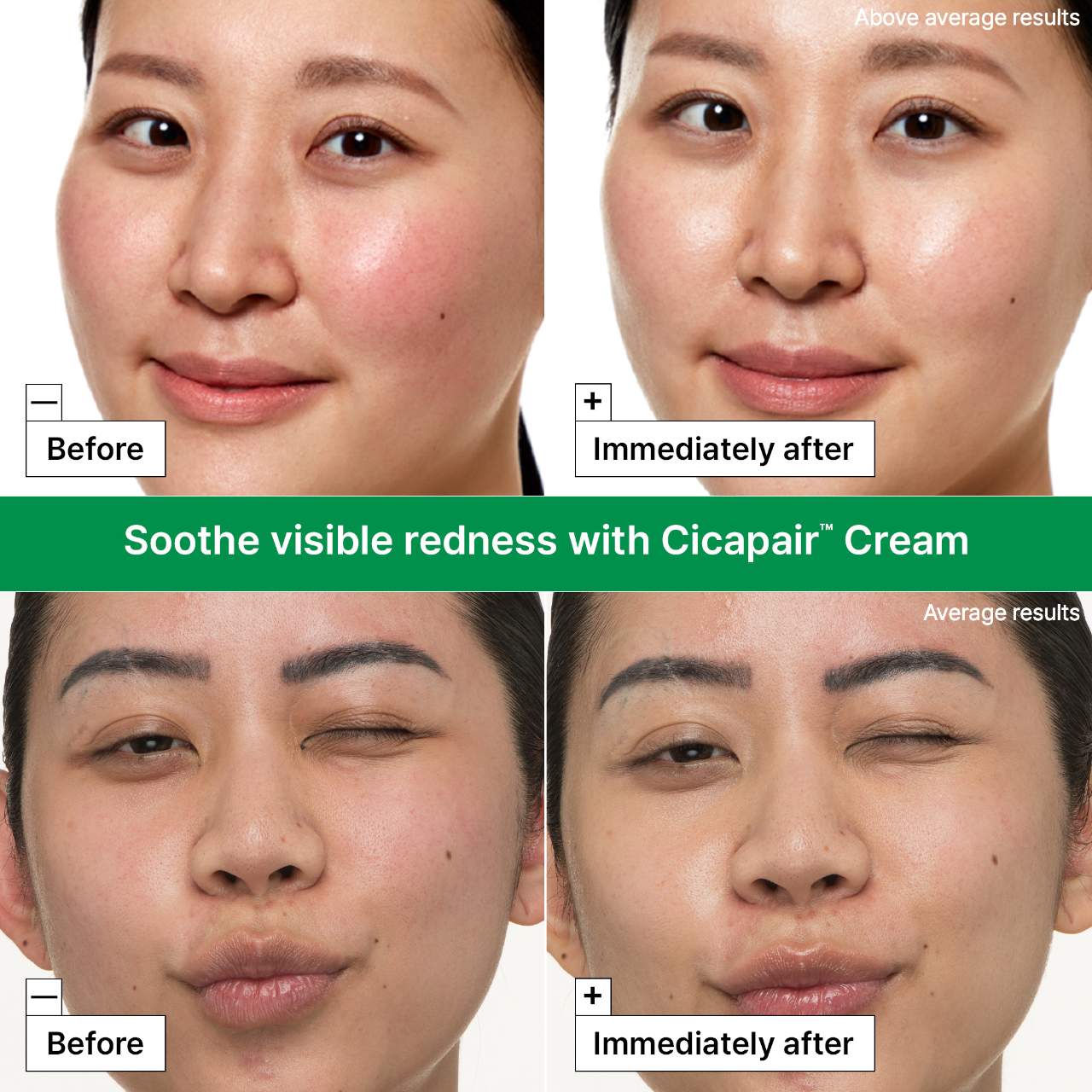 Dr. Jart+ - Cicapair™ Redness Rescue Kit for Sensitive Skin