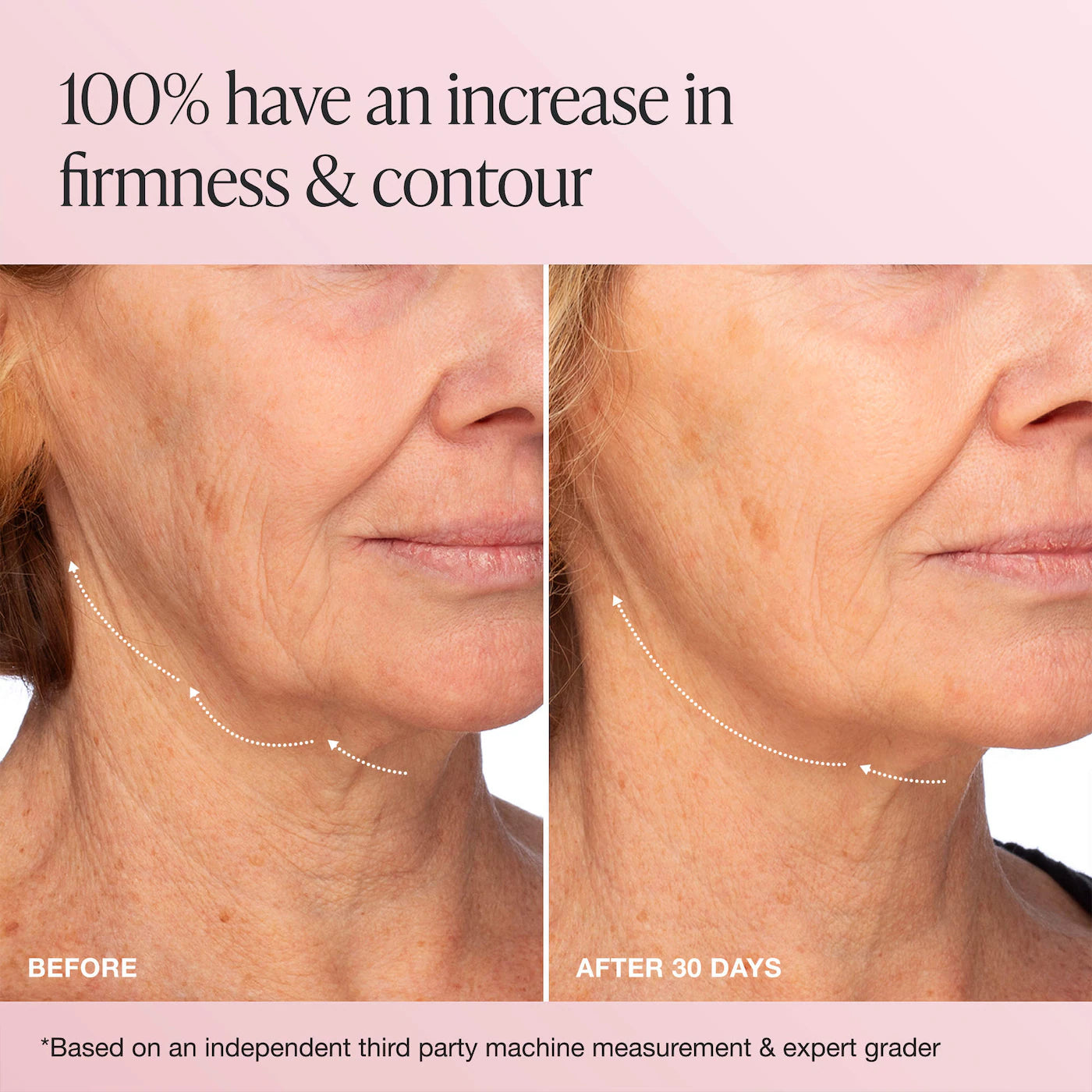 INNBEAUTY Project - Extreme Cream Anti-Aging, Firming, & Lifting Refillable Moisturizer | 50 mL