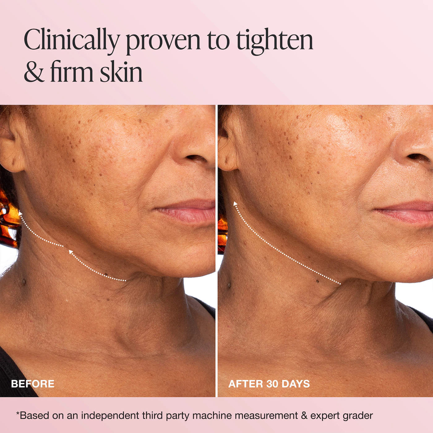 INNBEAUTY Project - Extreme Cream Anti-Aging, Firming, & Lifting Refillable Moisturizer | 50 mL