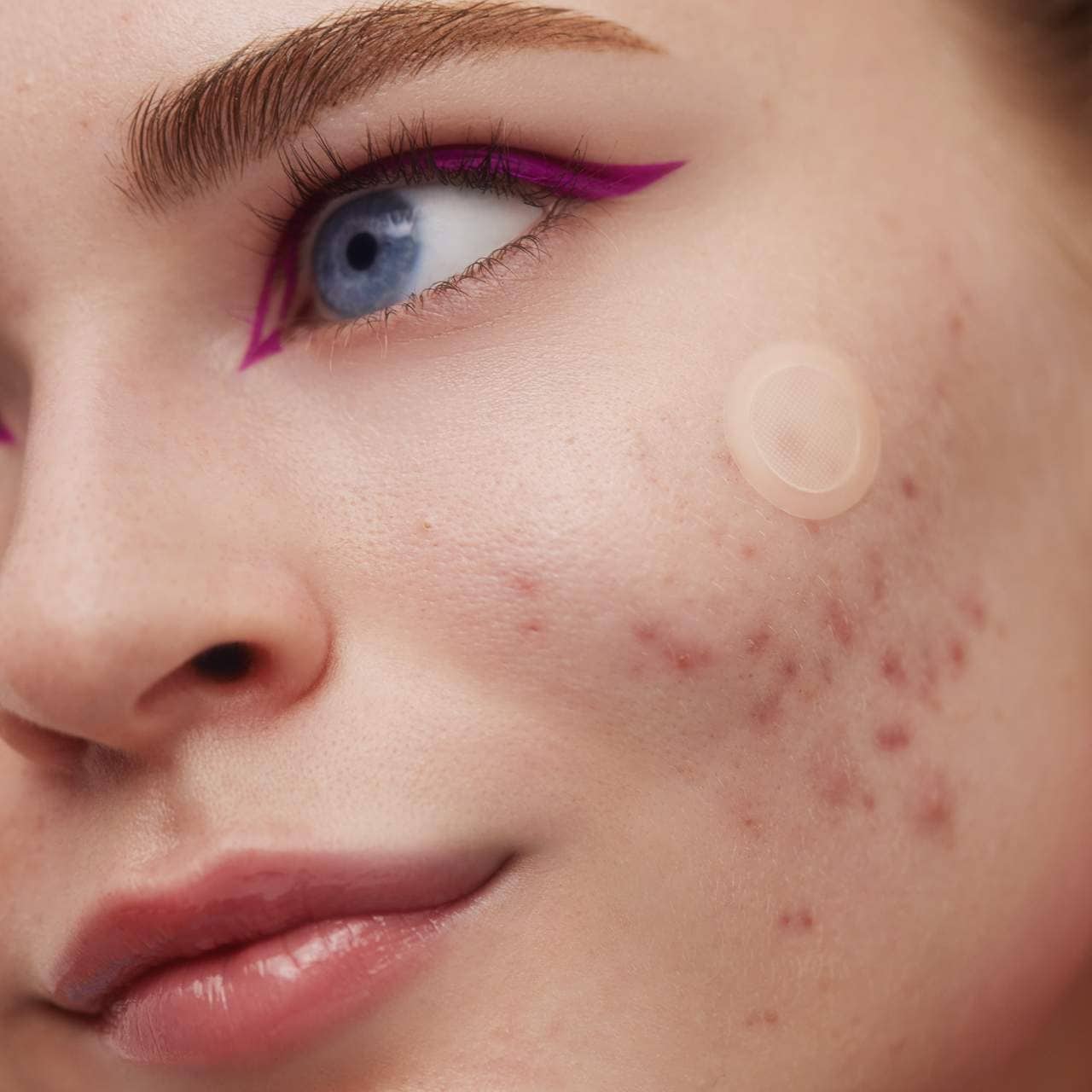 Peace Out - 2% Salicylic Acid Early Stage Acne Dot