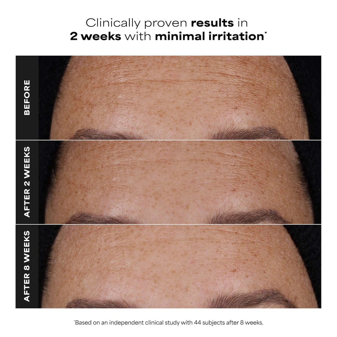 Paula's Choice - Clinical PRO Retinaldehyde Dual-Retinoid Treatment for Clear, Luminous Skin | 30 mL