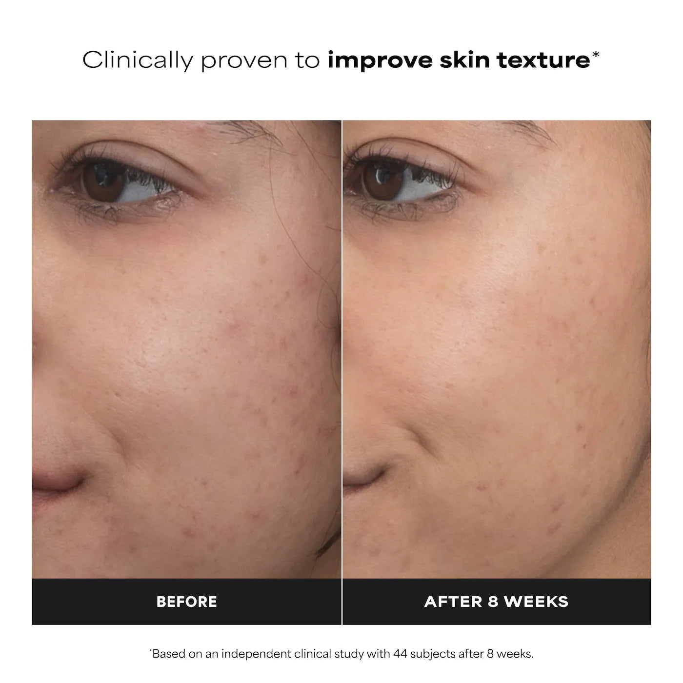 Paula's Choice - Clinical PRO Retinaldehyde Dual-Retinoid Treatment for Clear, Luminous Skin | 30 mL