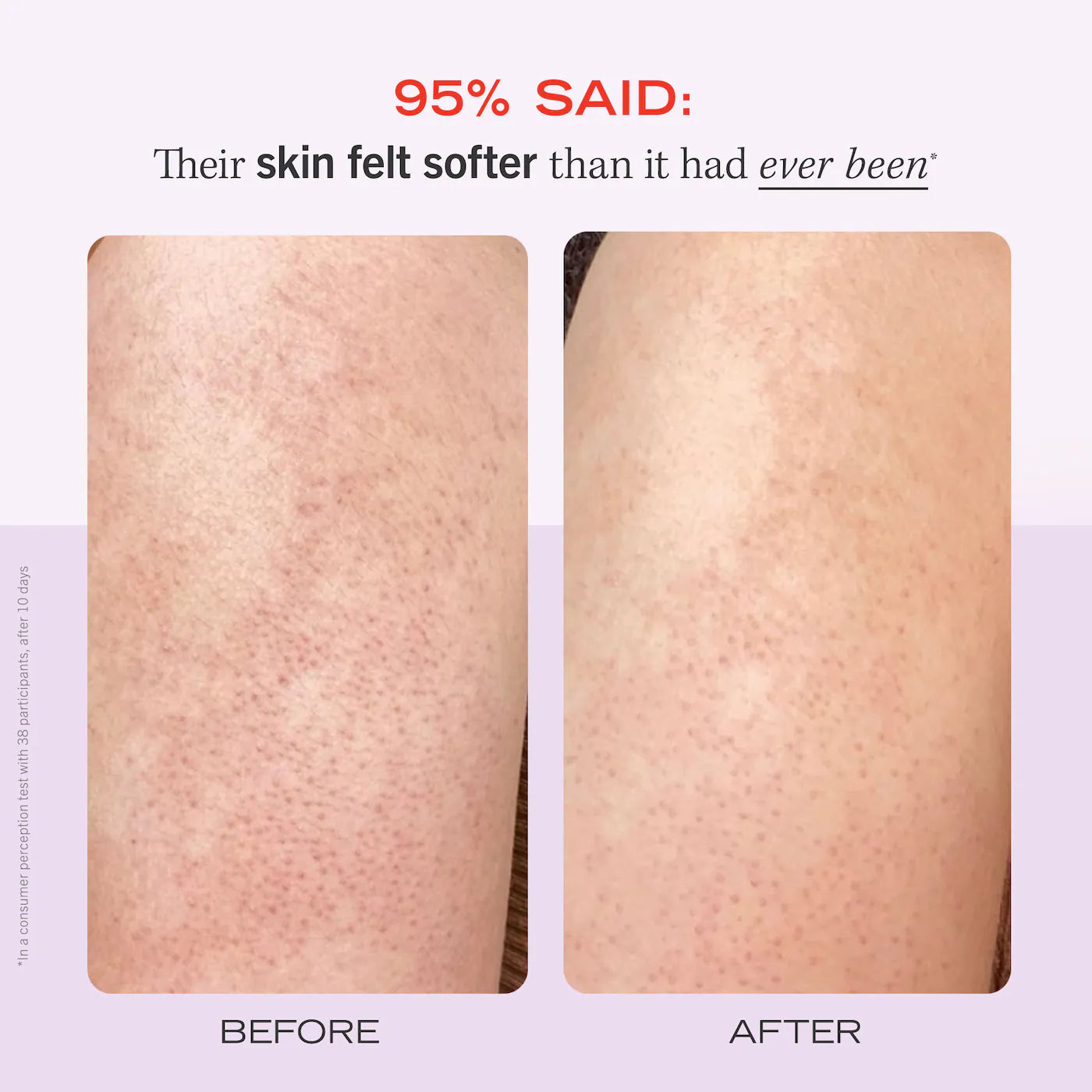First Aid Beauty - KP BUMP ERASER BODY SCRUB 10% AHA | 226 g | Strawberry