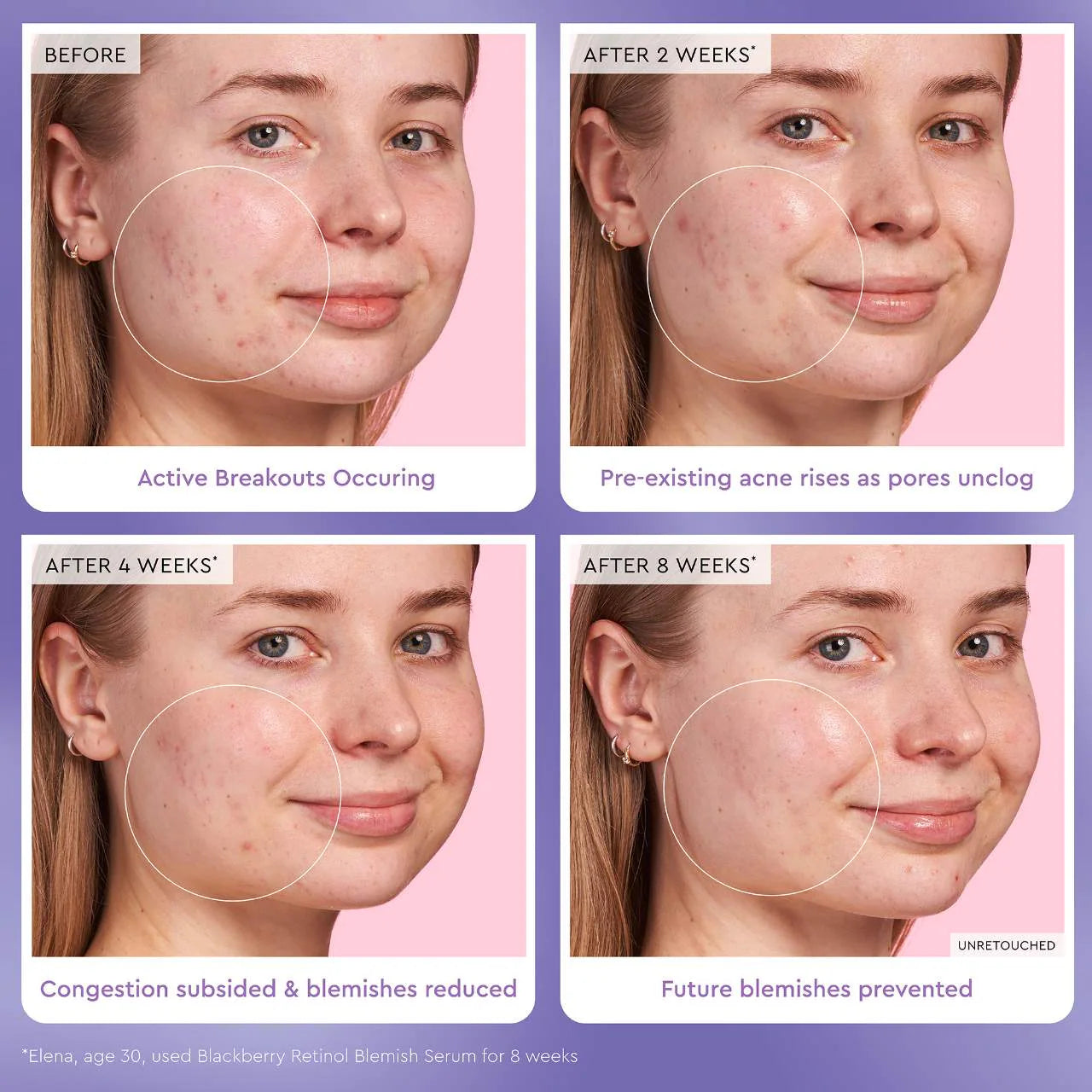 Glow Recipe - Blackberry Retinol Blemish Serum | 30 mL