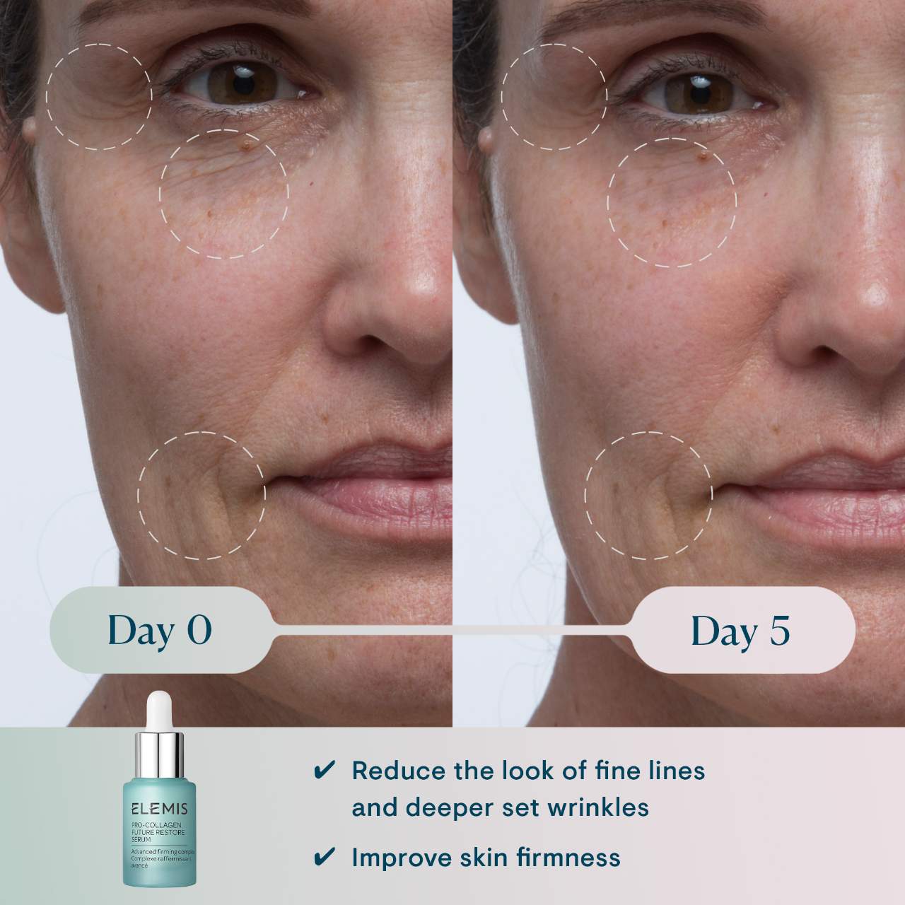 elemis - pro collagen future restore serum | 15 ml