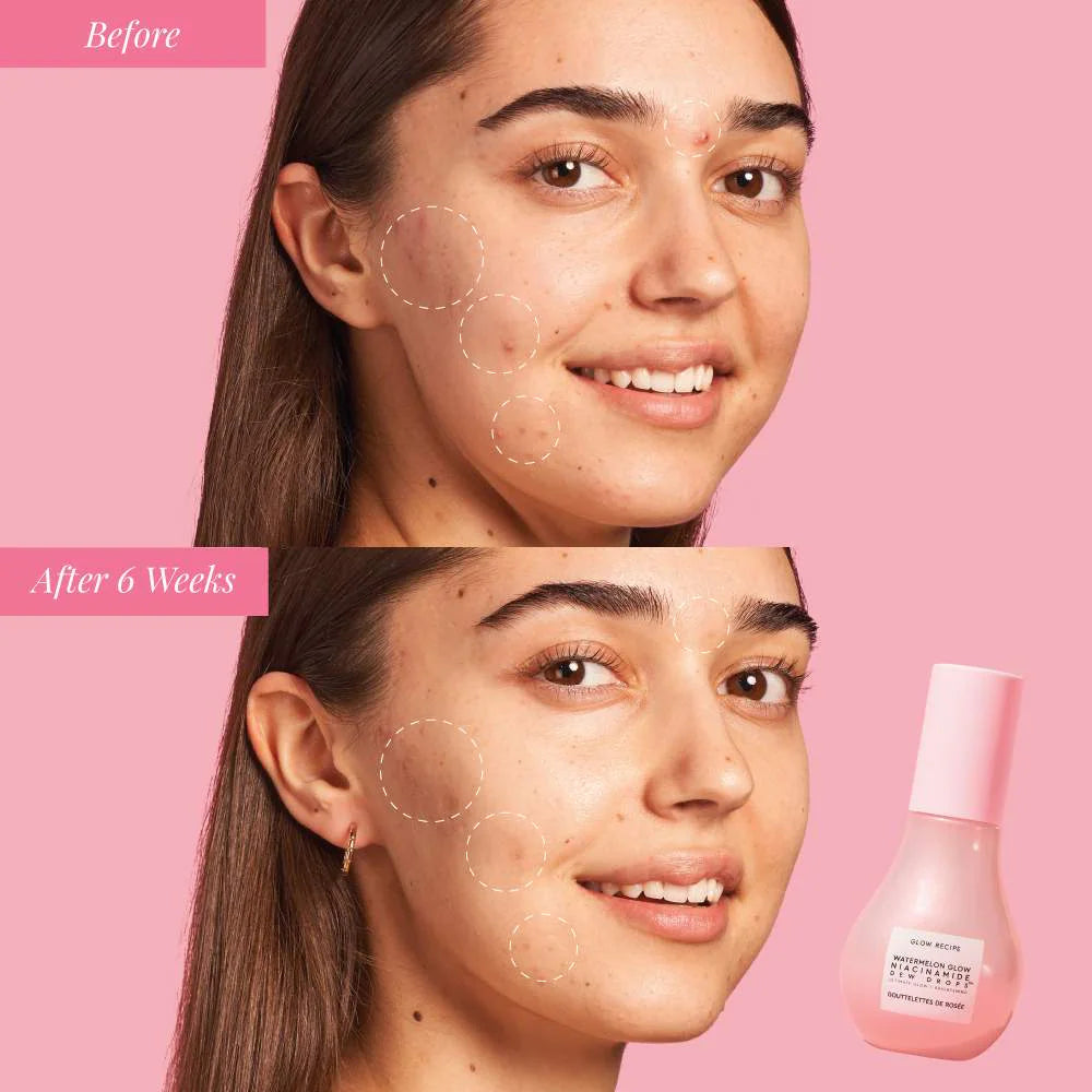 Glow Recipe - Watermelon Glow Niacinamide Dew Drops