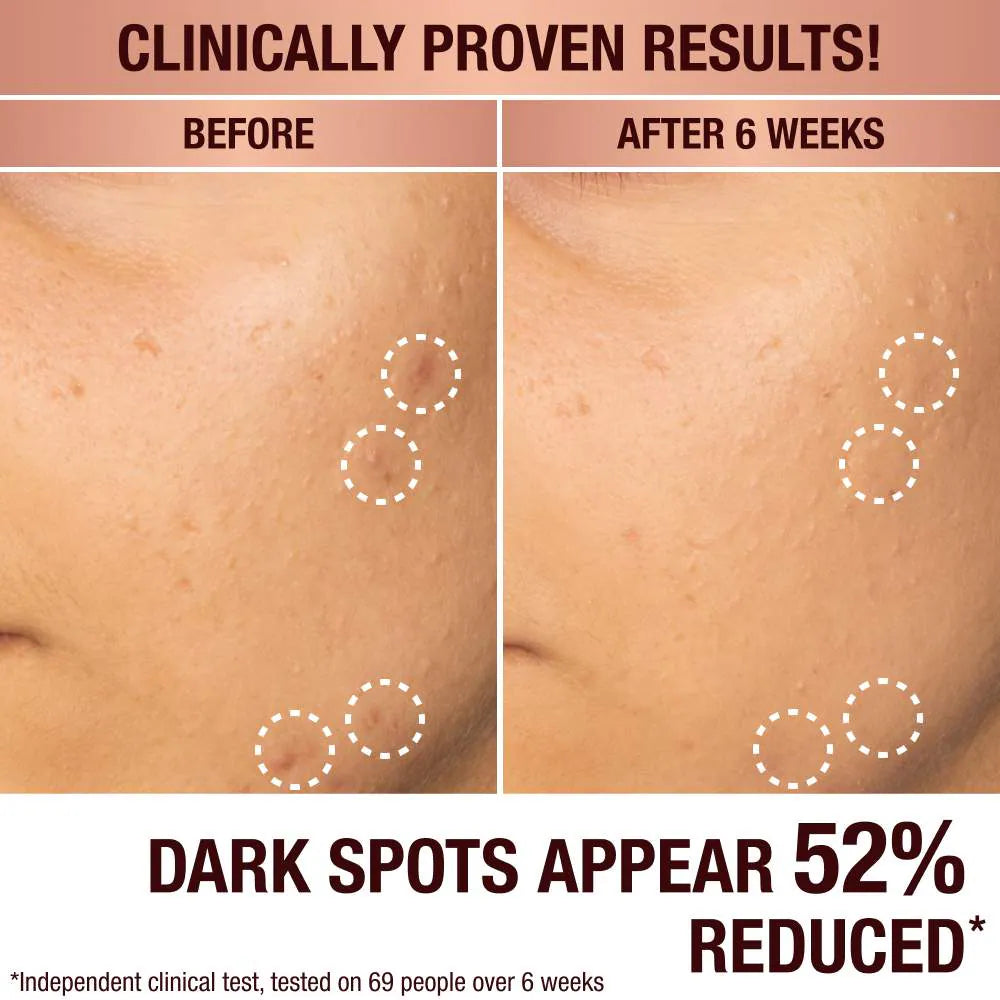 Charlotte Tilbury - Dark Spot Correcting Radiance Recovery Serum | 30 mL