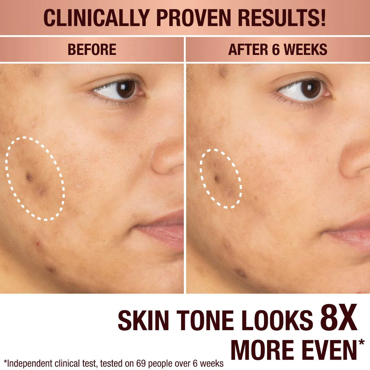 Charlotte Tilbury - Dark Spot Correcting Radiance Recovery Serum | 30 mL