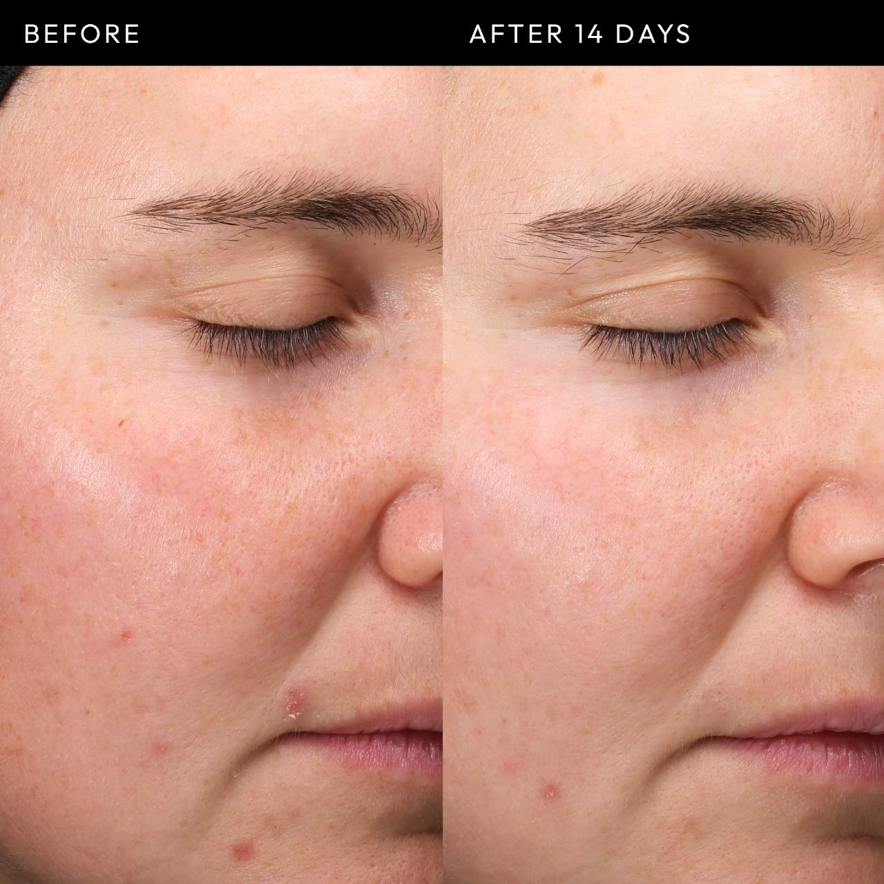 THE INKEY LIST - Exosome Hydro-Glow Complex | 30 ML