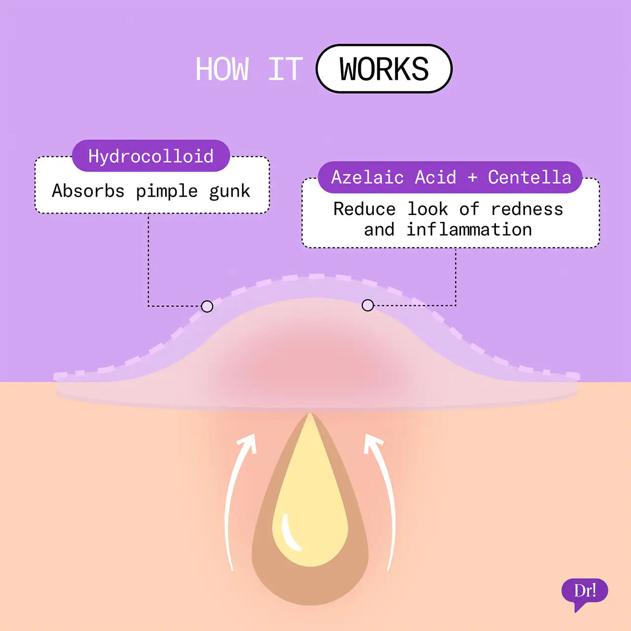 Dr. Idriss - Patch It Azelaic Acid Rescue Pimple Patches | 24 PATCHES