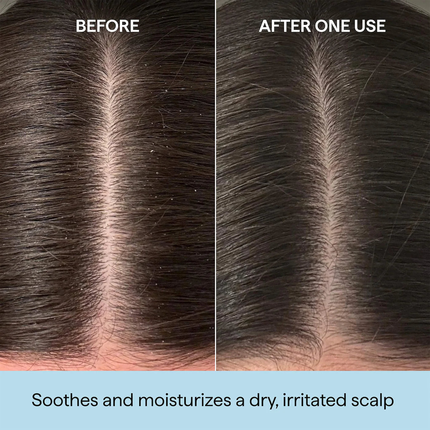 Briogeo - Scalp Revival™ Rosemary Pre-Wash Scalp and Hair Oil