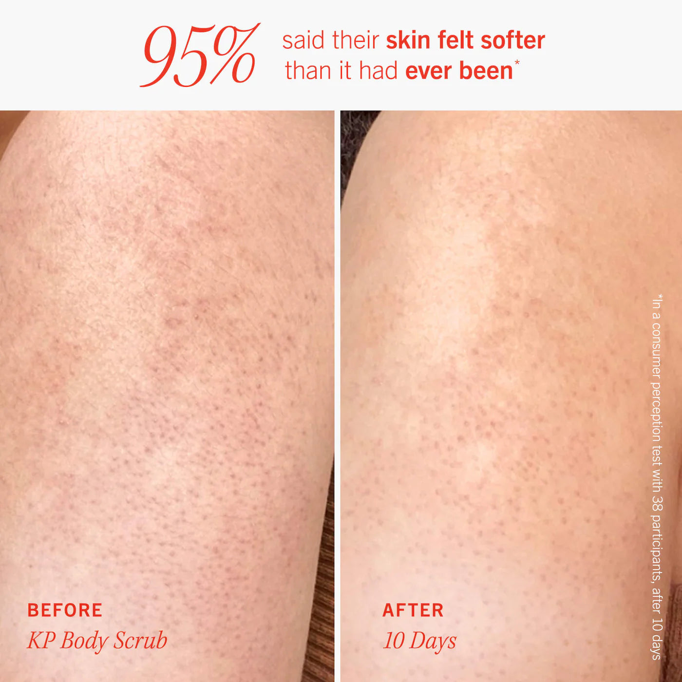 First Aid Beauty - Soft + Smooth Starter Kit