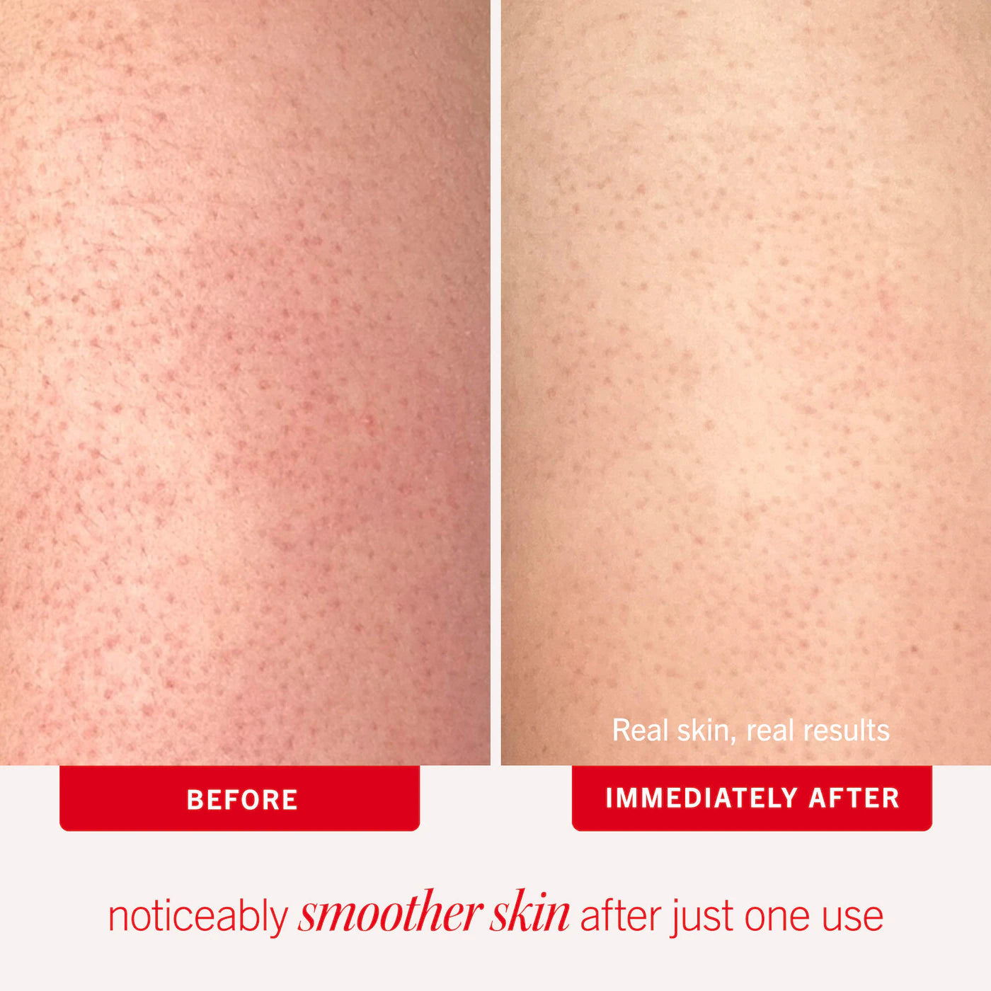 First Aid Beauty - KP Scented Trio