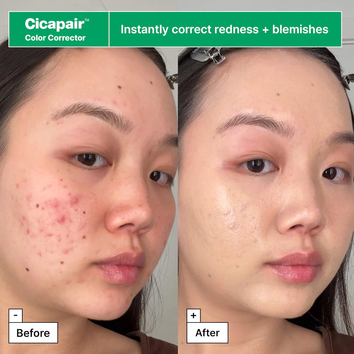 Dr. Jart+ - Cicapair™ Sensitive Skin Gift Set for Redness and Barrier Repair