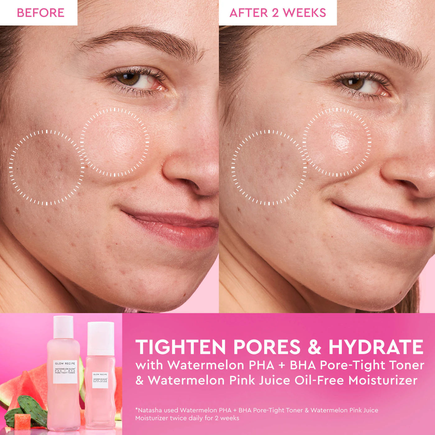 Glow Recipe - Watermelon Glow Dewy Skin Routine Gift Set