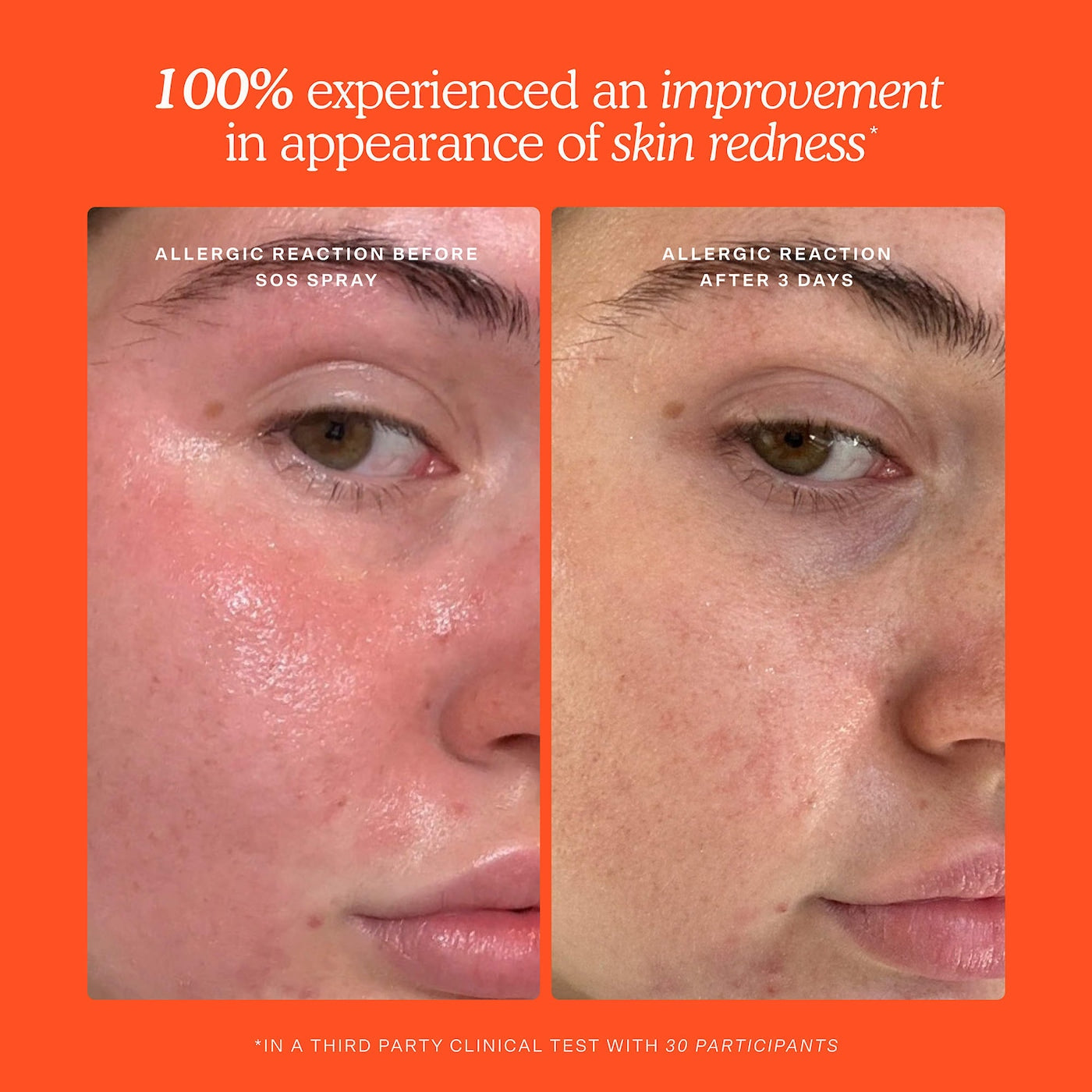 Tower 28 Beauty - Mini SOS Skincare Bestsellers Set