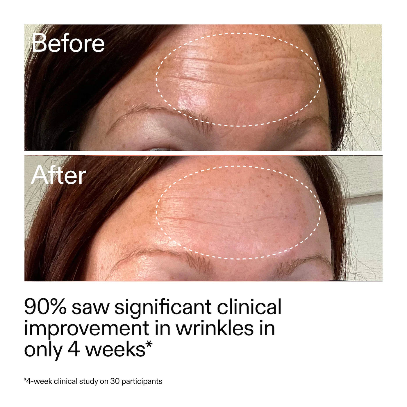 The INKEY List - Starter Retinol Serum for Fine lines + Wrinkles | 30 mL
