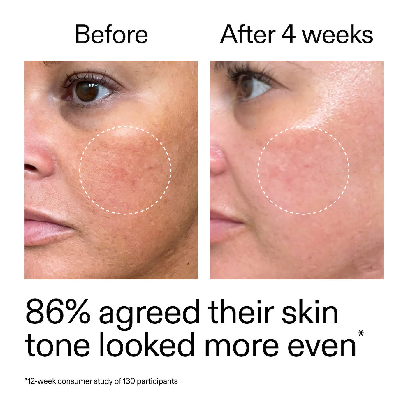 The INKEY List - Starter Retinol Serum for Fine lines + Wrinkles | 30 mL