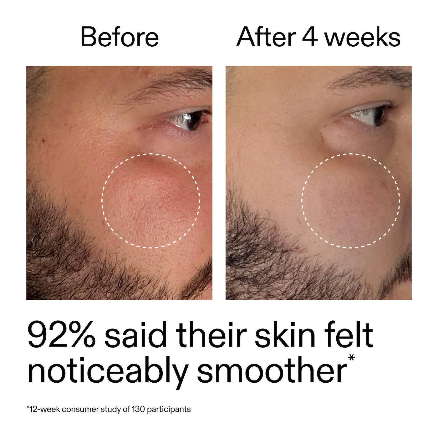 The INKEY List - Starter Retinol Serum for Fine lines + Wrinkles | 30 mL