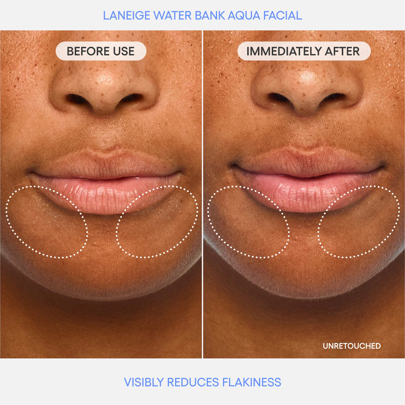 LANEIGE - Water Bank Aqua Facial Serum BHA + AHA - Gently Exfoliate, Hydrate & Glow | 30 mL