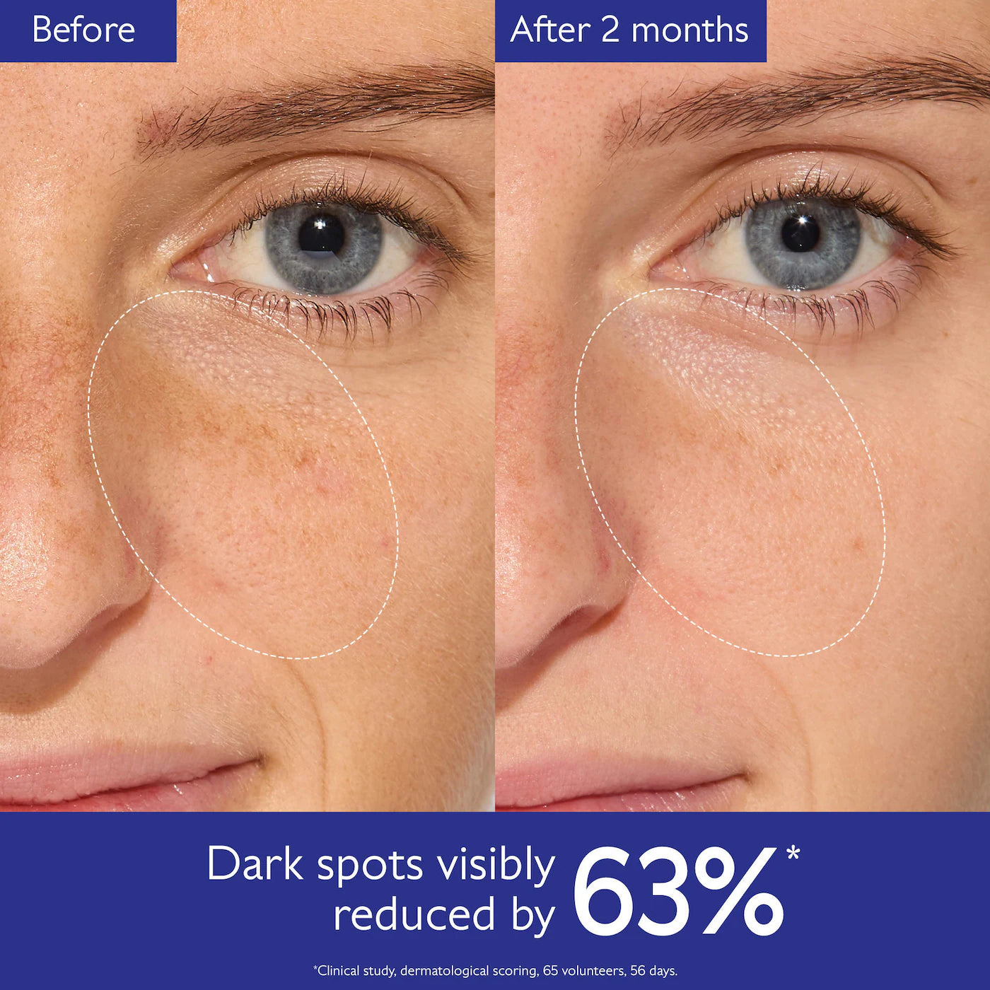 Caudalie - Vinoperfect Brightening Set for Dark Spots and Uneven Skin Tone
