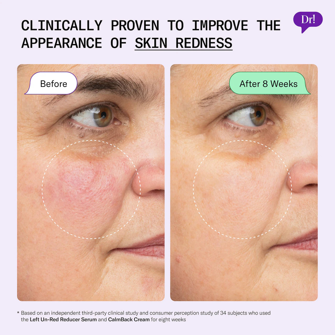 Dr. Idriss - Left Un-Red Reducer Face Serum for Redness and Blemish Prone Skin | 28 mL