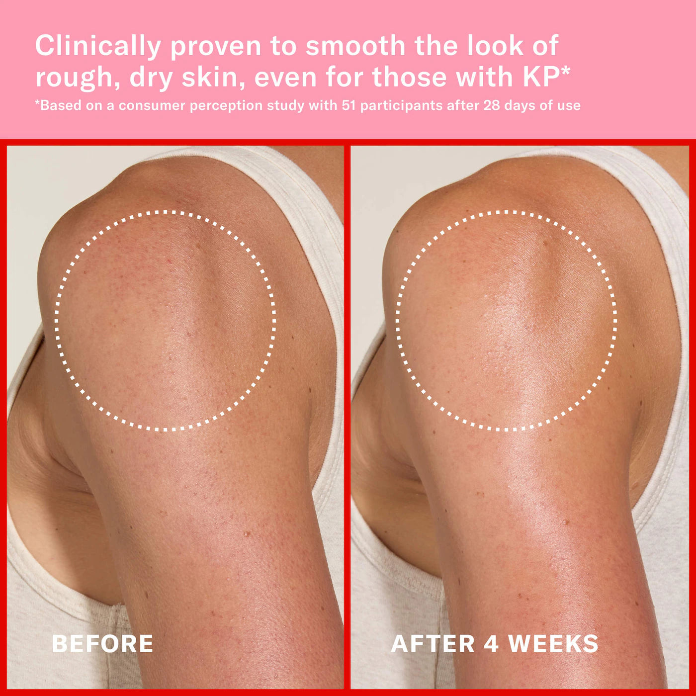JOSIE MARAN - Pink Algae Pro-Retinol Body Butter for Anti-Aging and KP | Always Nude, Unscented