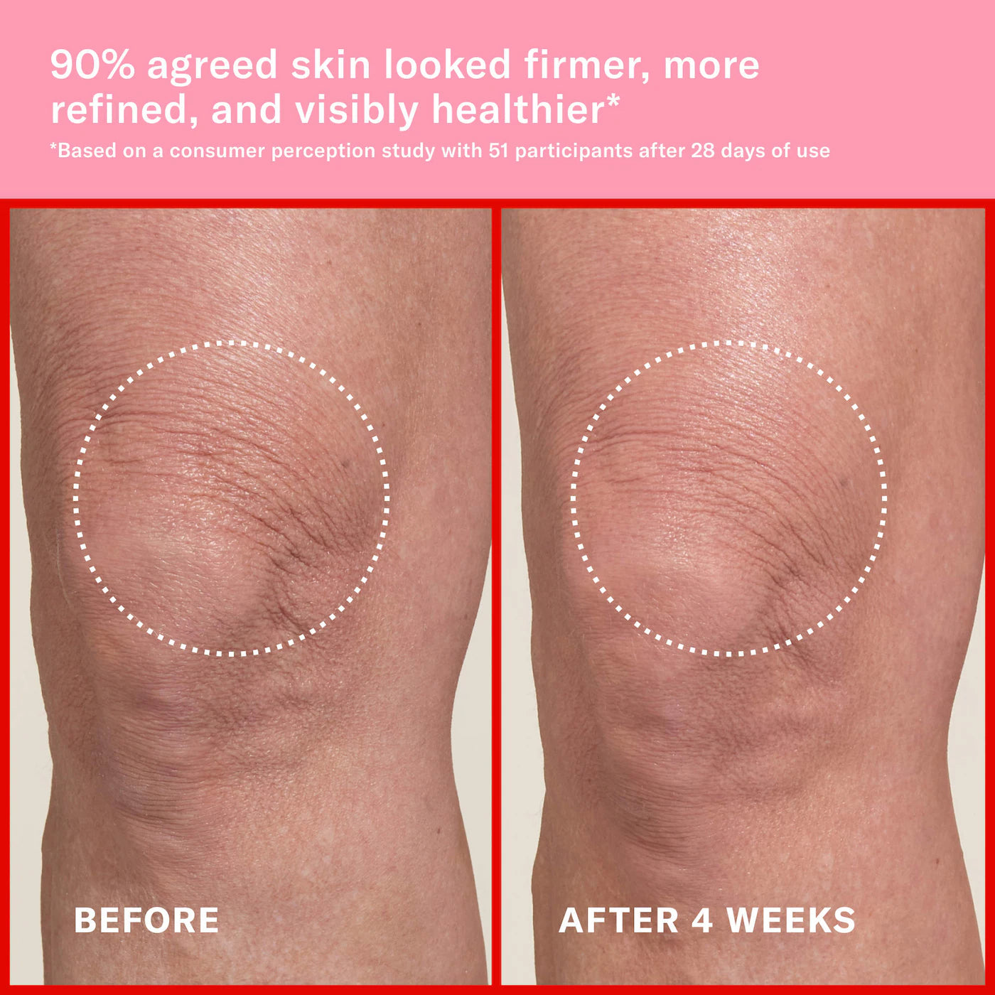 JOSIE MARAN - Pink Algae Pro-Retinol Body Butter for Anti-Aging and KP | Always Nude, Unscented