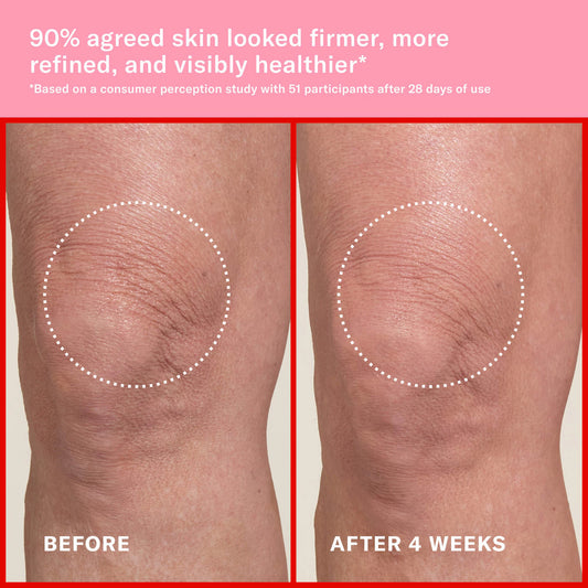 JOSIE MARAN - Pink Algae Pro-Retinol Body Butter for Anti-Aging and KP | Always Nude, Unscented