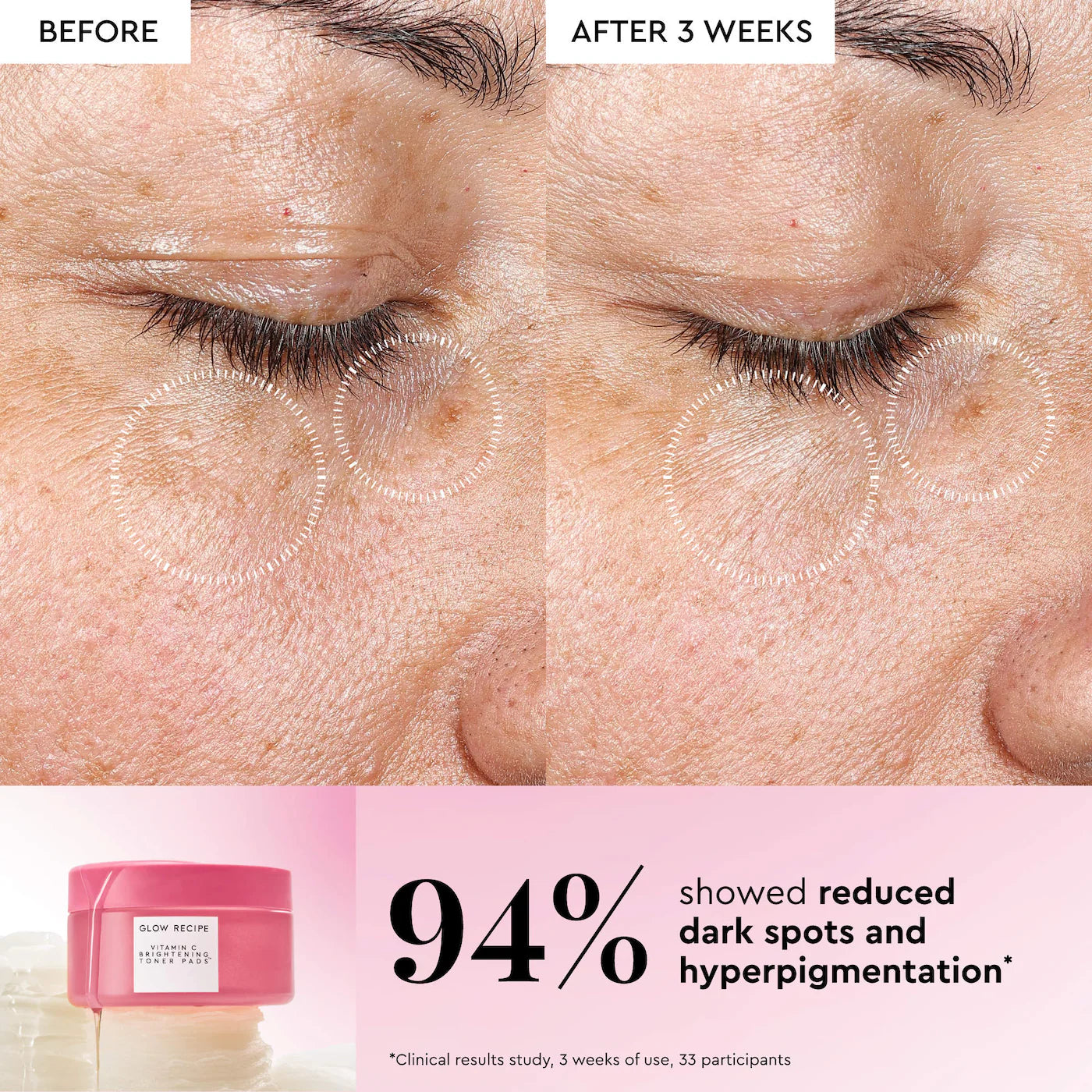 Glow Recipe - Vitamin C Brightening Korean Guava Toner Pads for Undereye & Cheeks | 60 Pads