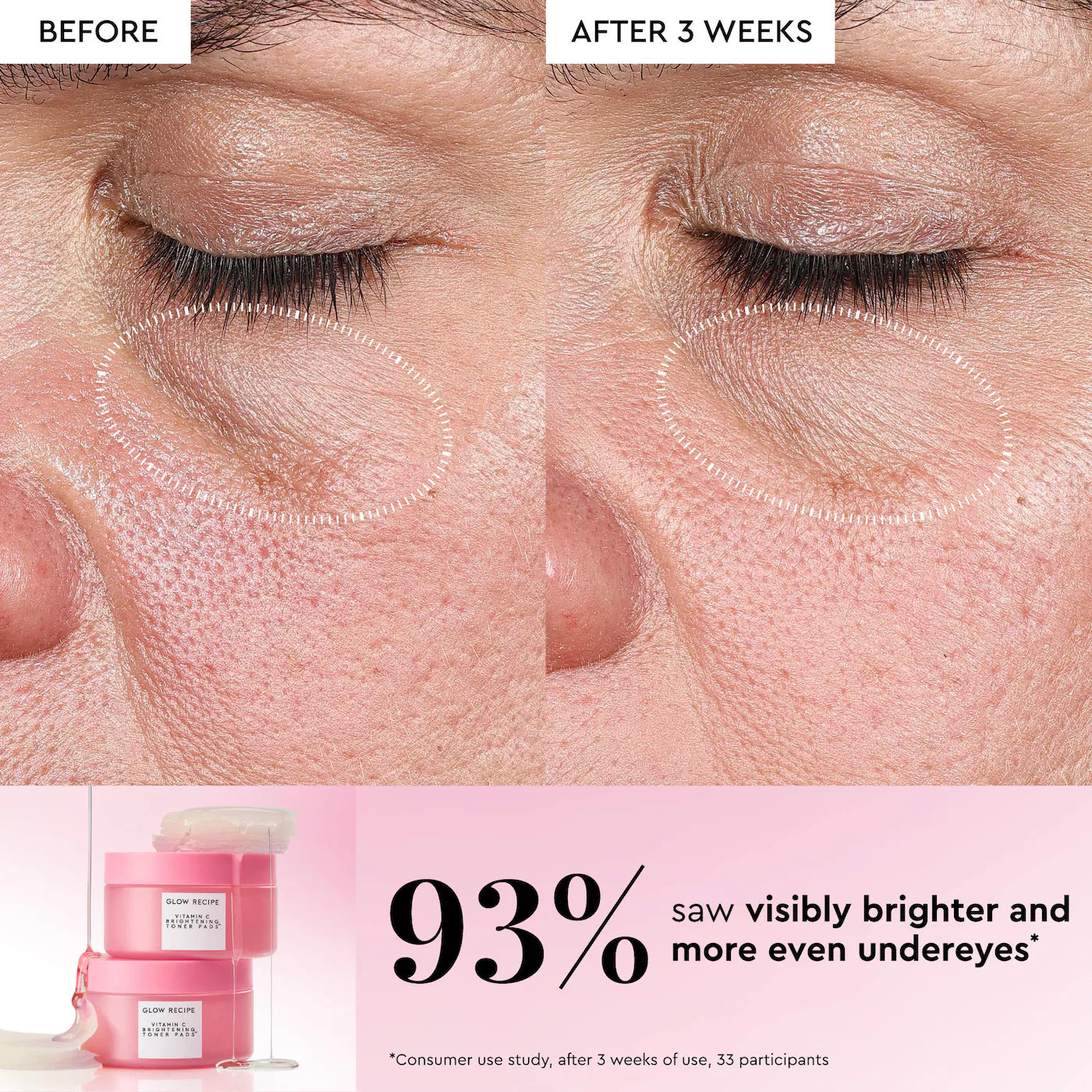 Glow Recipe - Vitamin C Brightening Korean Guava Toner Pads for Undereye & Cheeks | 60 Pads