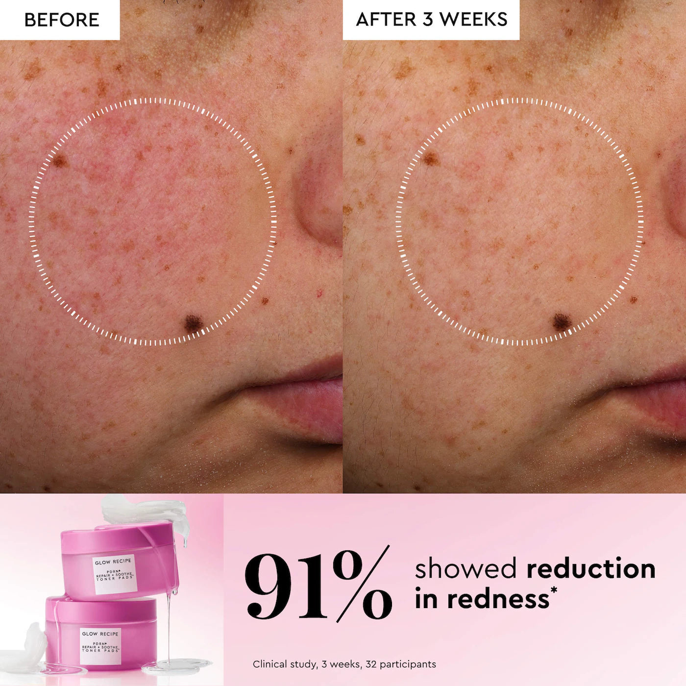 Glow Recipe - PDRN Repair + Soothe Korean Prickly Pear Toner Pads for Skin Barrier Repair | 60 Pads