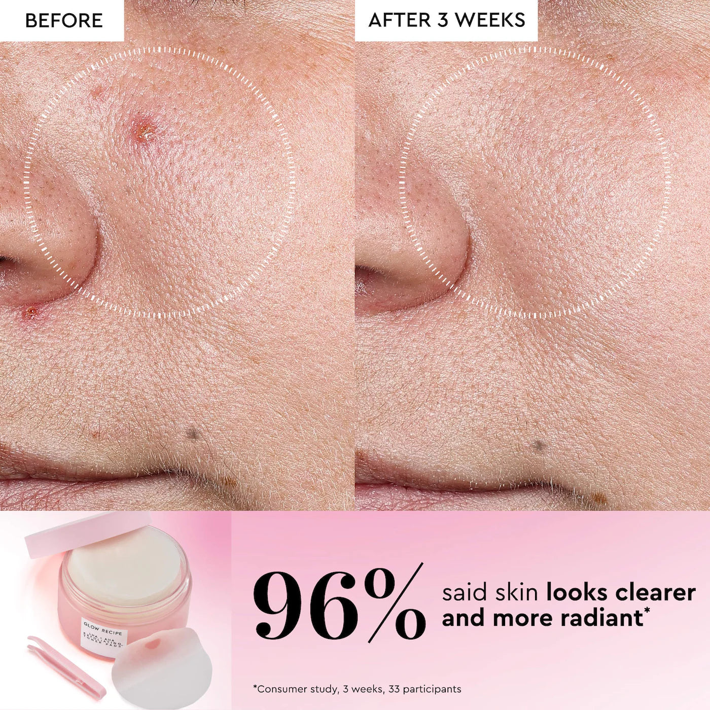 Glow Recipe - LHA + AHA Korean Watermelon Toner Pads for Hydration and Gentle Exfoliation | 60 Pads