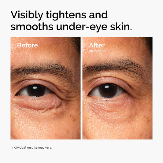 The Ordinary - Lacto-PDRN* 4% + B9 Eye Cream | 15 mL