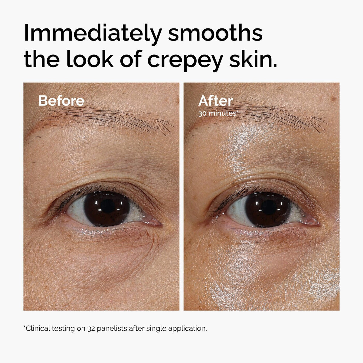 The Ordinary - Lacto-PDRN* 4% + B9 Eye Cream | 15 mL