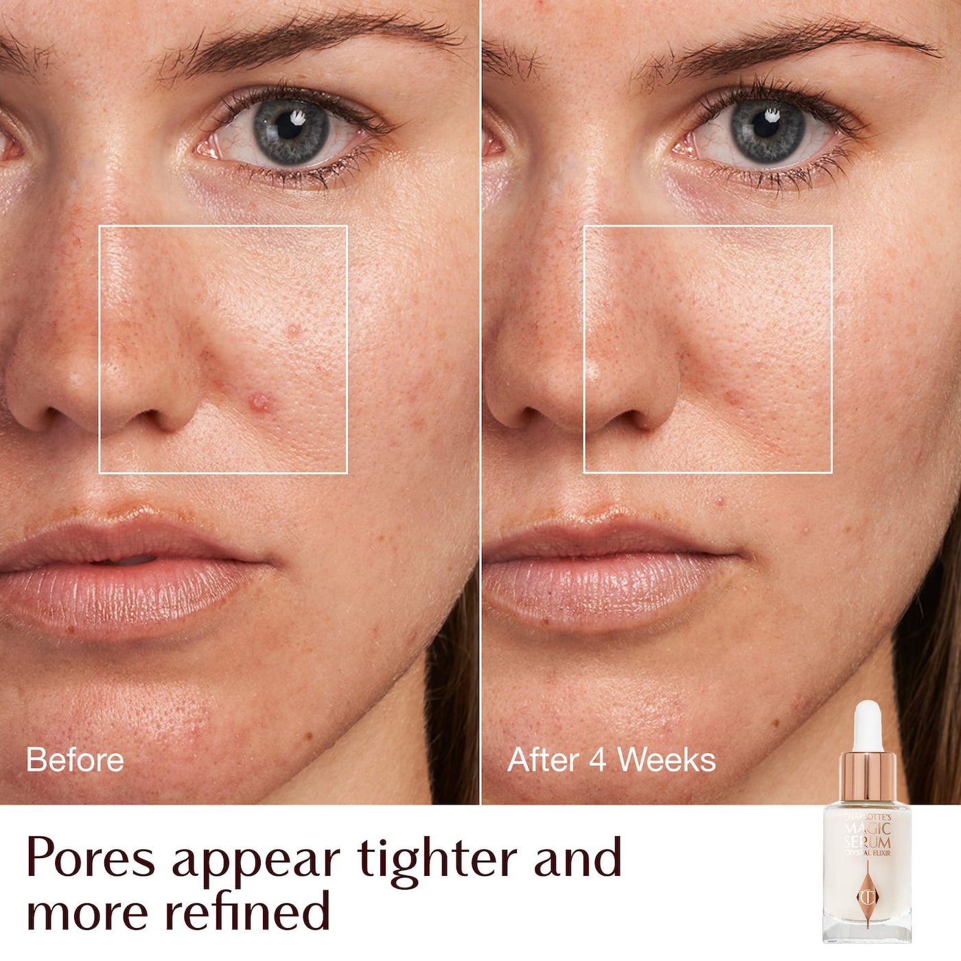 Charlotte Tilbury - Charlotte's Hydrate, Plump & Glow Set