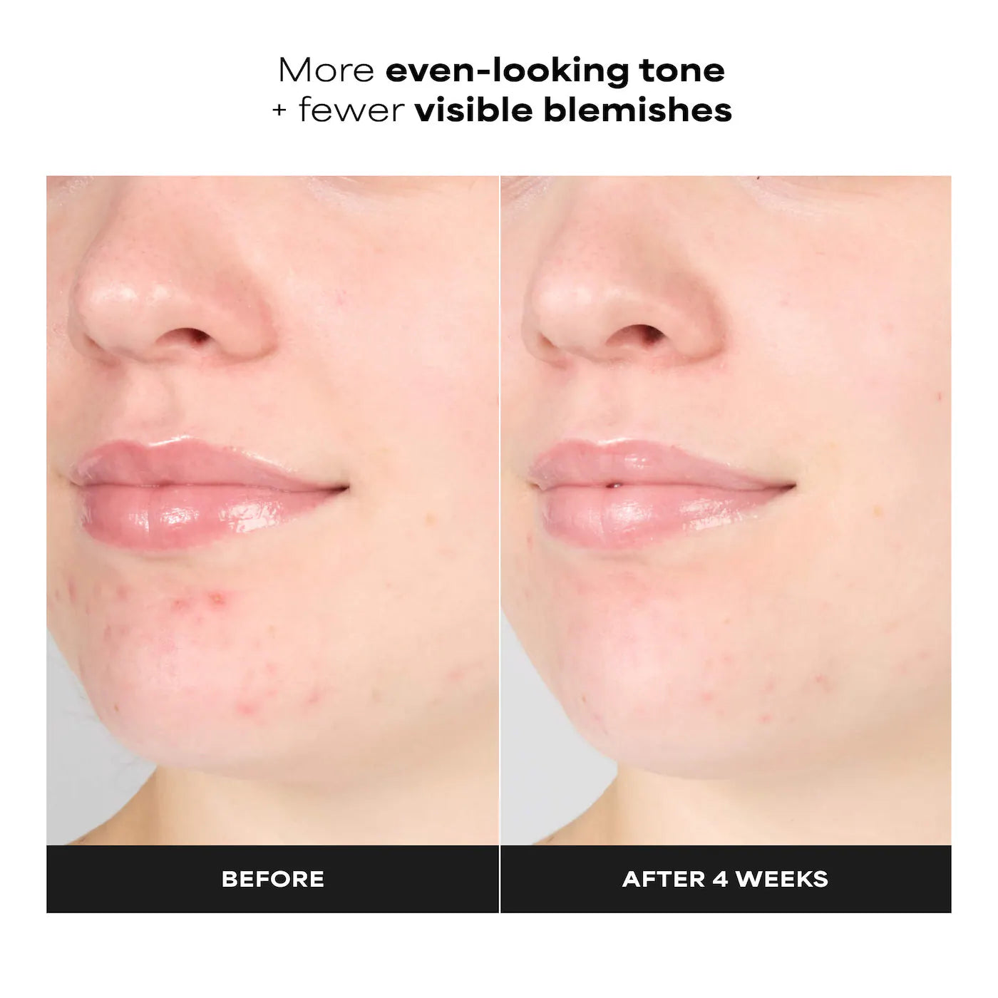 Paula's Choice - Skin Perfecting 1% BHA Gentle Exfoliating Gel Toner for Sensitive Skin | 100 mL