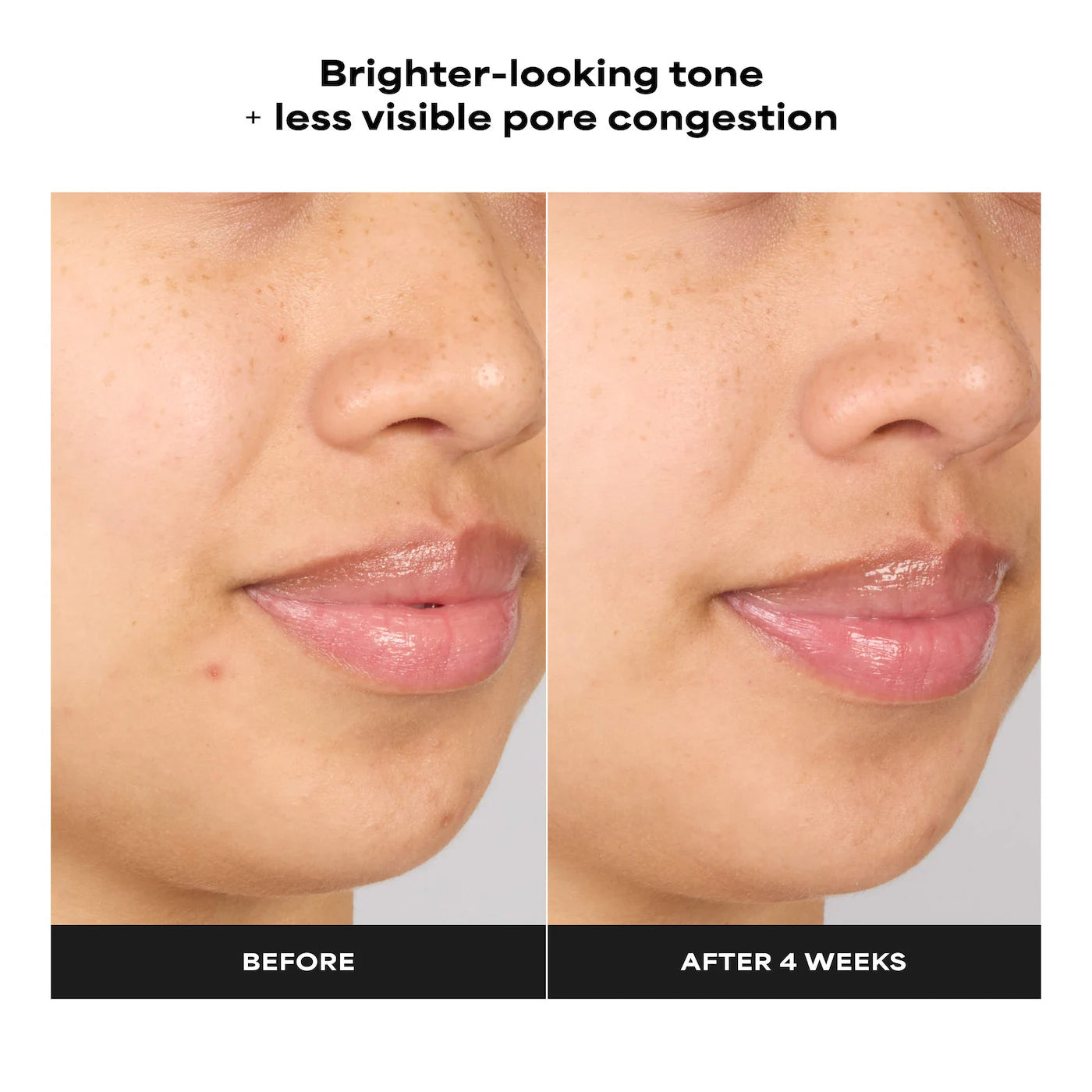 Paula's Choice - Skin Perfecting 4% BHA Advanced Exfoliating Serum Toner | 30 mL